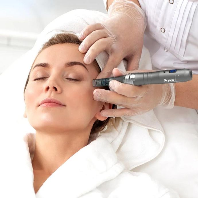 Microneedling Facial Treatment at Allcare Acupuncture